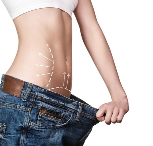 Are you a good candidate for a tummy tuck? 